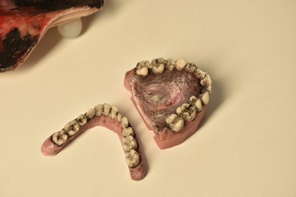 Modular Burn Victim Skills Partial Airway Trainer (Caucasian) - Image 6
