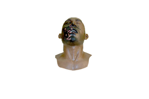 Burn Victim Skills Kit - Image 4